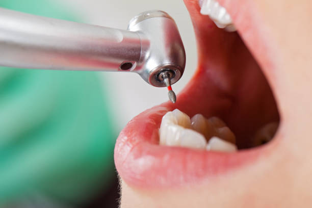 Best Emergency Orthodontic Repairs in Wallace, ID